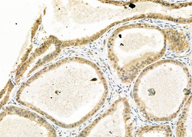 MOZ Antibody in Immunohistochemistry (Paraffin) (IHC (P))