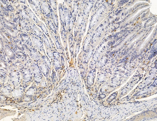TIAF1 Antibody in Immunohistochemistry (Paraffin) (IHC (P))