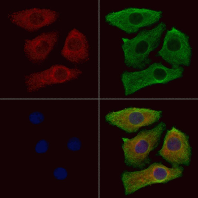 MYLPF Antibody in Immunocytochemistry (ICC/IF)