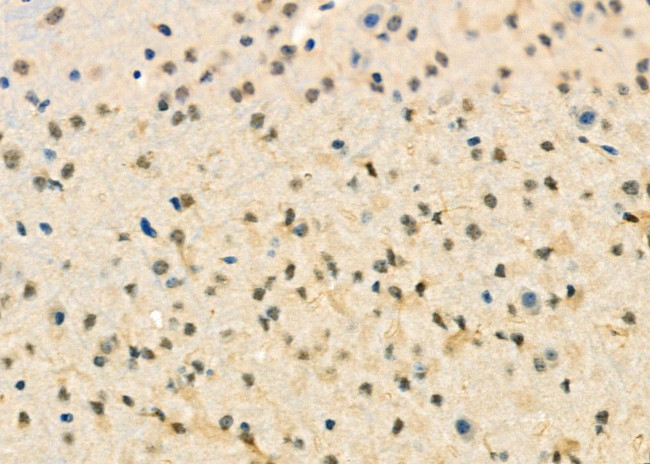 CENPC Antibody in Immunohistochemistry (Paraffin) (IHC (P))