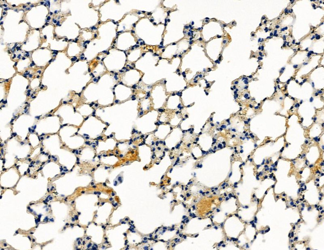 CENPK Antibody in Immunohistochemistry (Paraffin) (IHC (P))
