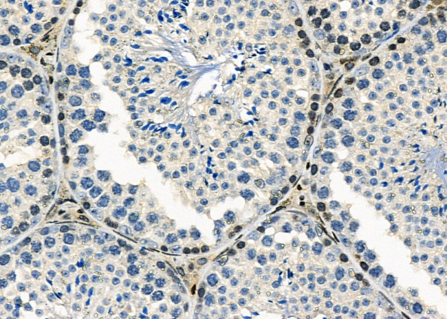 MYCNOS Antibody in Immunohistochemistry (Paraffin) (IHC (P))