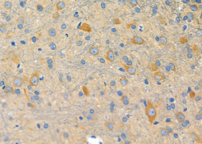 CREB3L4 Antibody in Immunohistochemistry (Paraffin) (IHC (P))