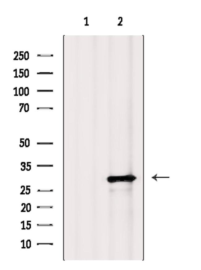 ALKBH2 Antibody in Western Blot (WB)