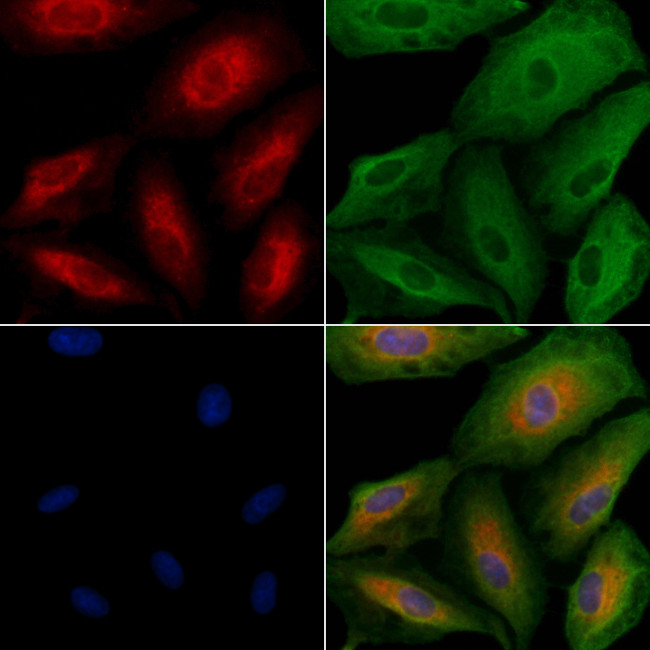 ALKBH7 Antibody in Immunocytochemistry (ICC/IF)