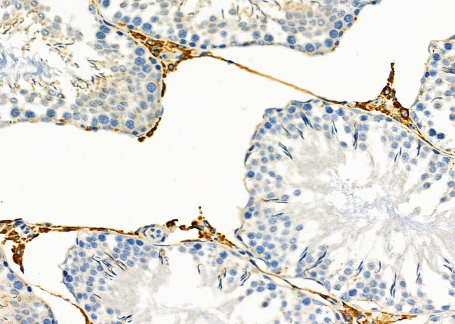 GEMIN8 Antibody in Immunohistochemistry (Paraffin) (IHC (P))