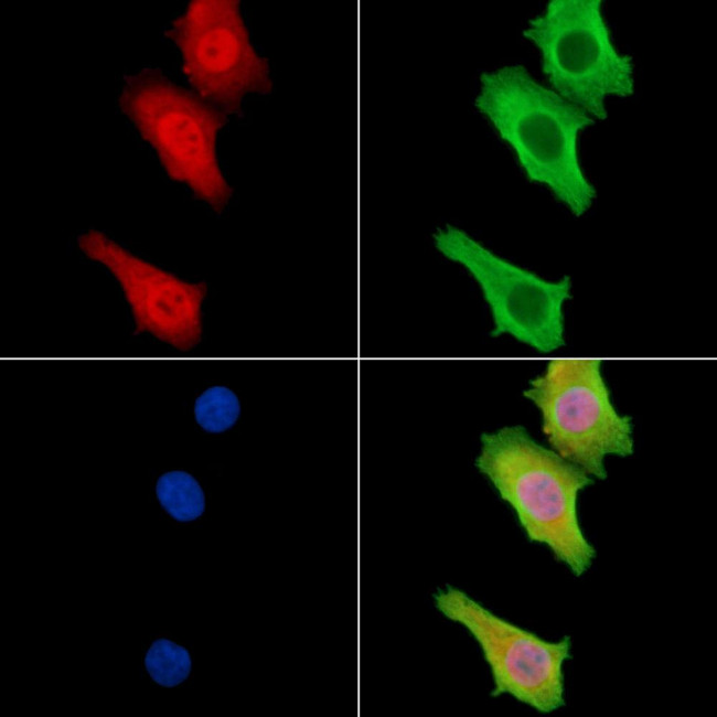 TNIP3 Antibody in Immunocytochemistry (ICC/IF)