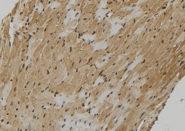FMR1NB Antibody in Immunohistochemistry (Paraffin) (IHC (P))