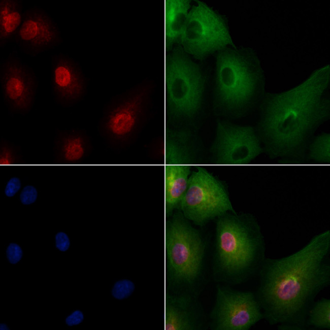 POU5F2 Antibody in Immunocytochemistry (ICC/IF)