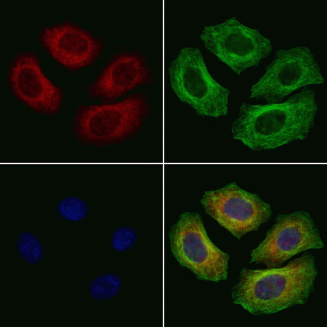 MRPS31 Antibody in Immunocytochemistry (ICC/IF)