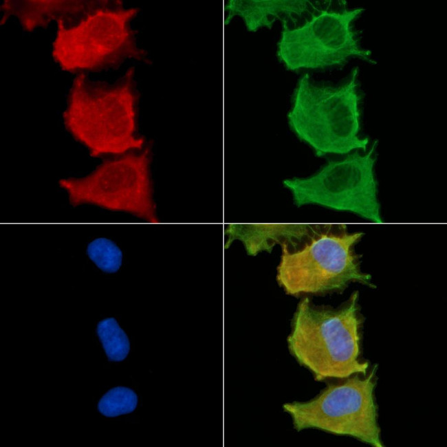 MOGAT3 Antibody in Immunocytochemistry (ICC/IF)