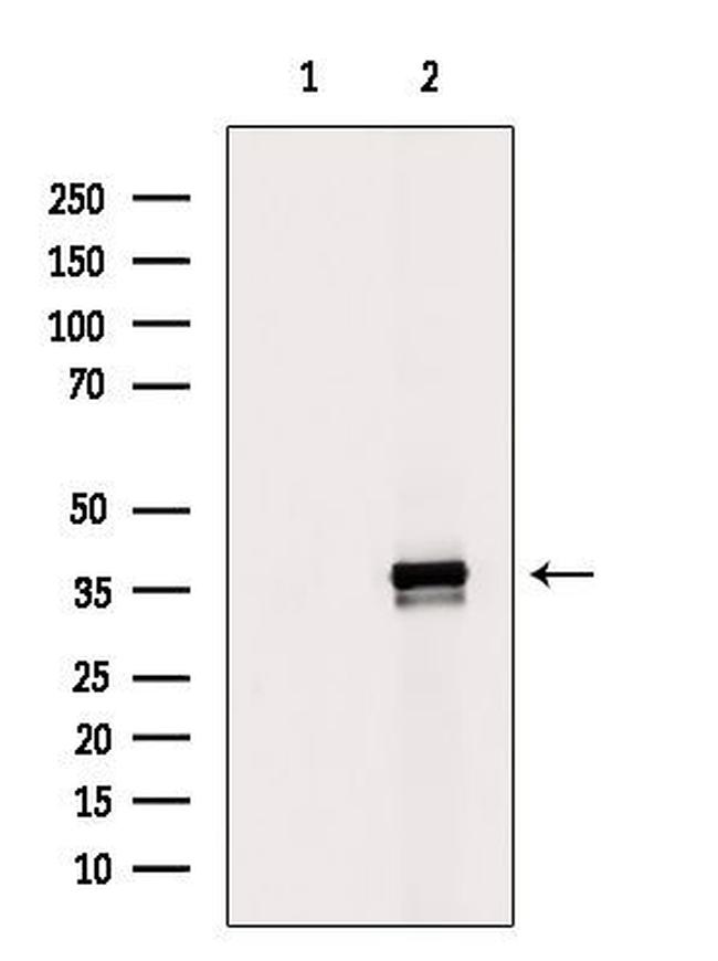 MRPL1 Antibody in Western Blot (WB)