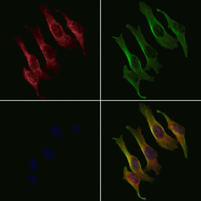 MRPL17 Antibody in Immunocytochemistry (ICC/IF)