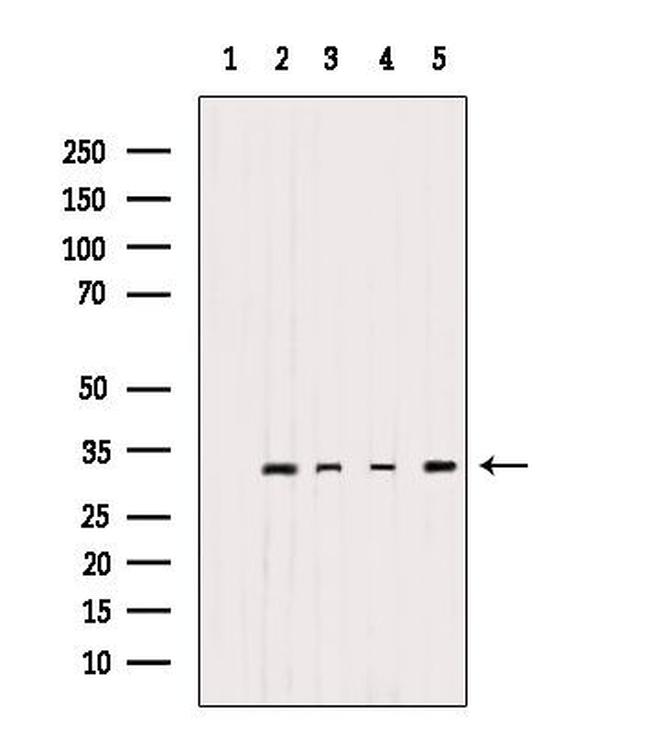 MRPL2 Antibody in Western Blot (WB)