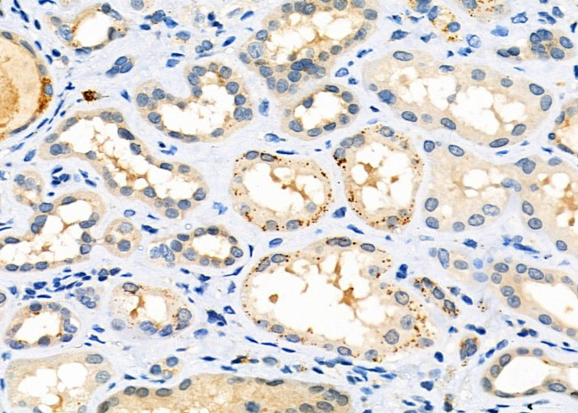 MRPL34 Antibody in Immunohistochemistry (Paraffin) (IHC (P))