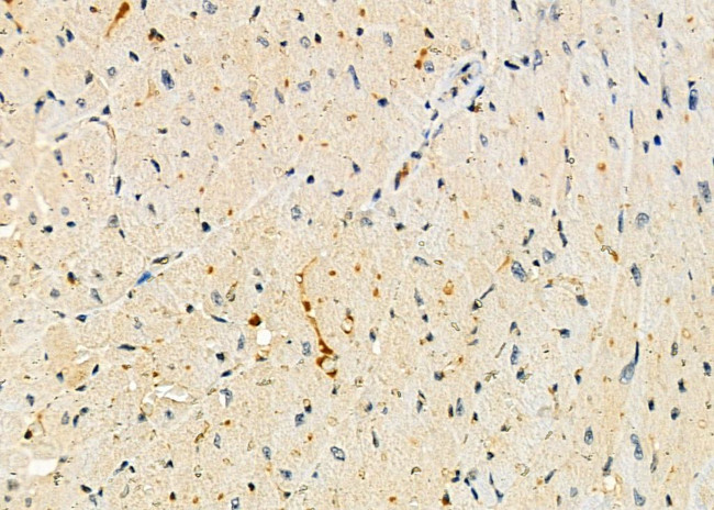 MRPL43 Antibody in Immunohistochemistry (Paraffin) (IHC (P))