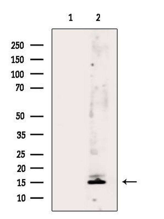 MRPL52 Antibody in Western Blot (WB)
