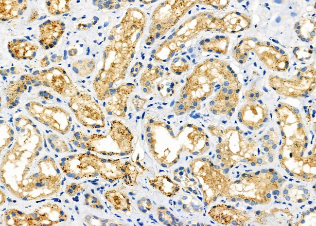 MRPL53 Antibody in Immunohistochemistry (Paraffin) (IHC (P))