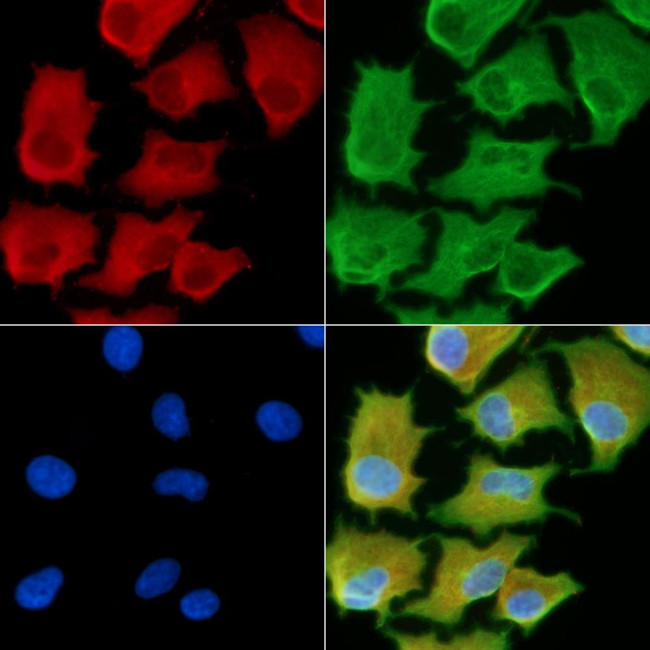 RPS15A Antibody in Immunocytochemistry (ICC/IF)