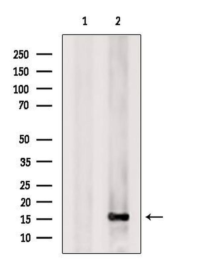 RPS17 Antibody in Western Blot (WB)