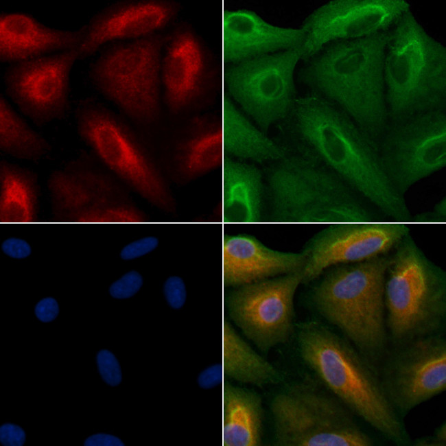 RPS21 Antibody in Immunocytochemistry (ICC/IF)