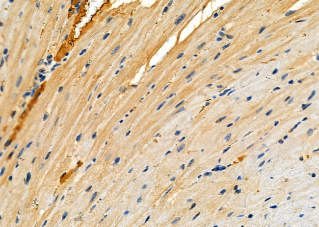 RPS26L1 Antibody in Immunohistochemistry (Paraffin) (IHC (P))