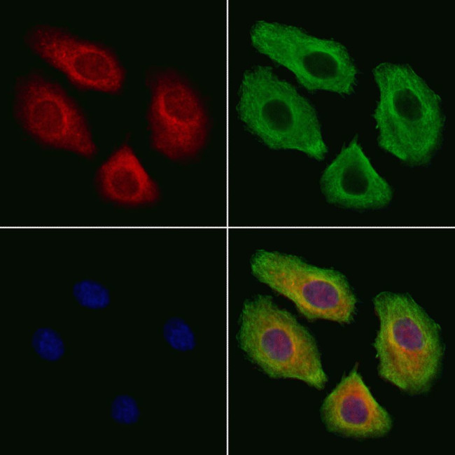 RPLP1 Antibody in Immunocytochemistry (ICC/IF)