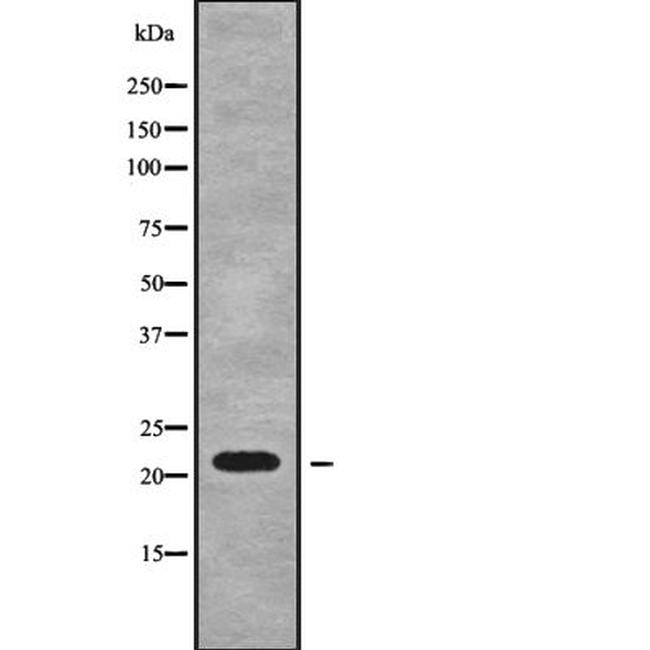 RPL18A Antibody in Western Blot (WB)