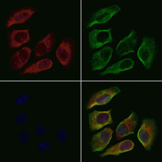 RPL35A Antibody in Immunocytochemistry (ICC/IF)