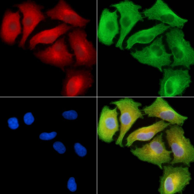RPL36AL Antibody in Immunocytochemistry (ICC/IF)