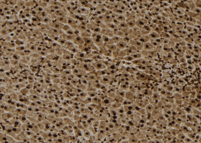 RPL4 Antibody in Immunohistochemistry (Paraffin) (IHC (P))