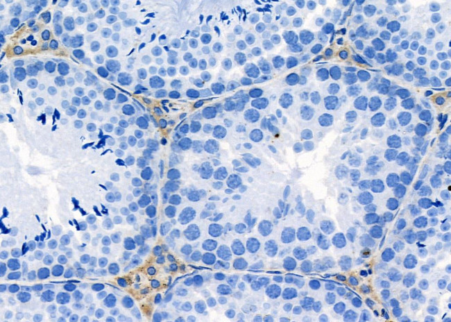 RPL41 Antibody in Immunohistochemistry (Paraffin) (IHC (P))