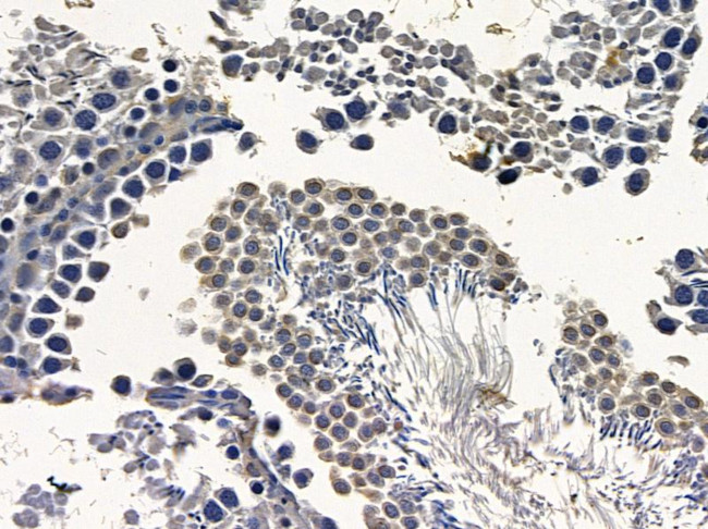 AFF4 Antibody in Immunohistochemistry (Paraffin) (IHC (P))