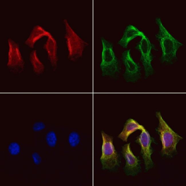 AGXT2 Antibody in Immunocytochemistry (ICC/IF)