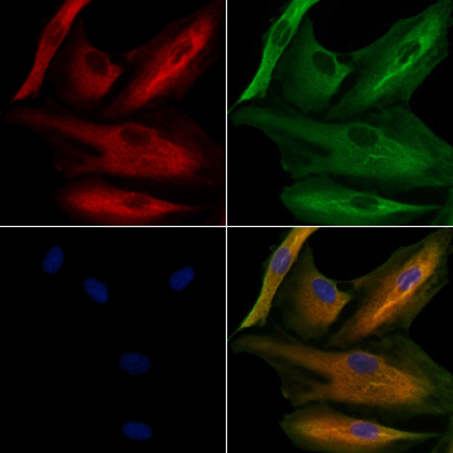 AKR1C4 Antibody in Immunocytochemistry (ICC/IF)