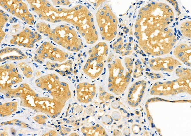SERPINA2 Antibody in Immunohistochemistry (Paraffin) (IHC (P))