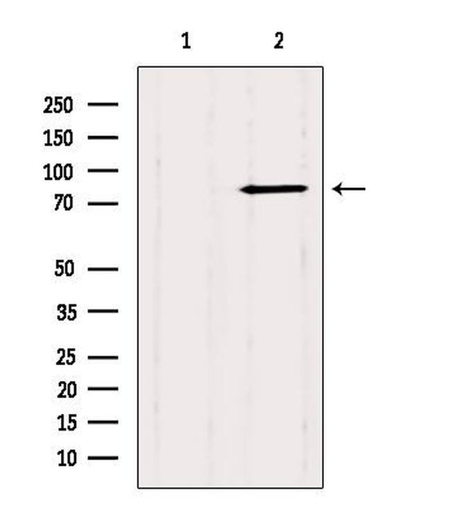 CTNNAL1 Antibody in Western Blot (WB)