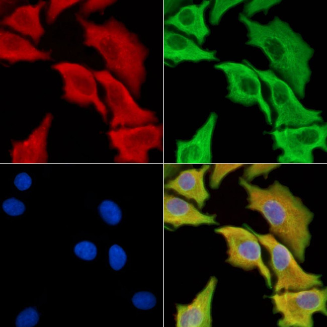 C3orf15 Antibody in Immunocytochemistry (ICC/IF)