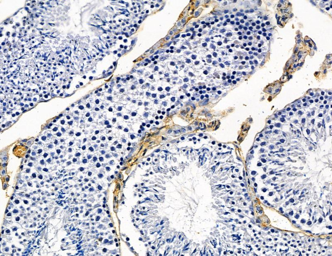 ALS2CR12 Antibody in Immunohistochemistry (Paraffin) (IHC (P))