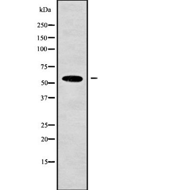 ATE1 Antibody in Western Blot (WB)