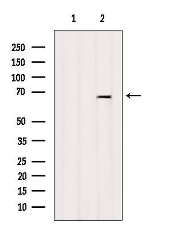 ARSJ Antibody in Western Blot (WB)
