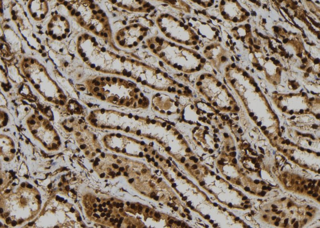 ATXN7L1 Antibody in Immunohistochemistry (Paraffin) (IHC (P))