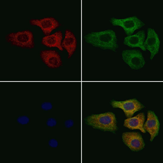 MT-ATP6 Antibody in Immunocytochemistry (ICC/IF)