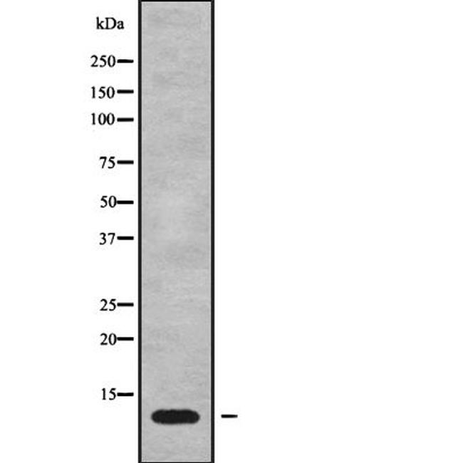 MT-ATP8 Antibody in Western Blot (WB)