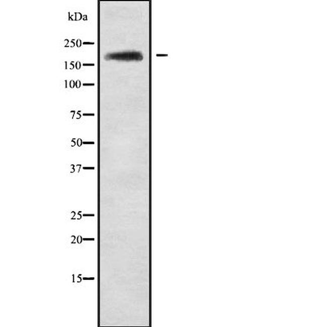 ABCA10 Antibody in Western Blot (WB)