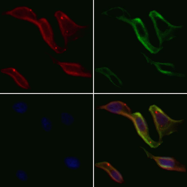 SUR1 Antibody in Immunocytochemistry (ICC/IF)