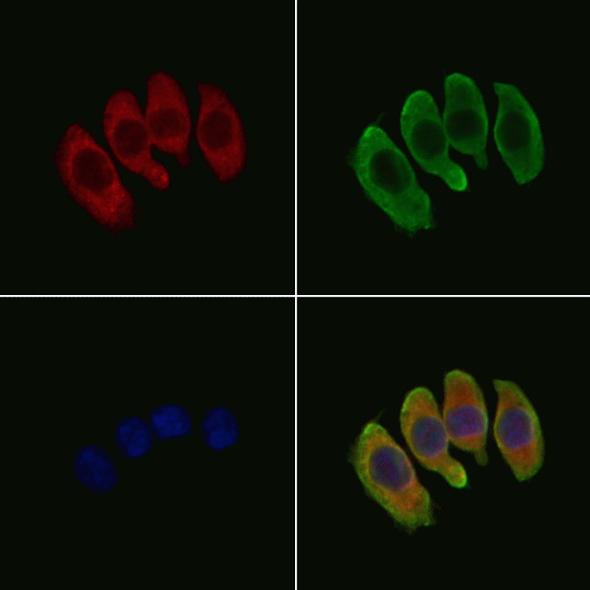 ABCC9 Antibody in Immunocytochemistry (ICC/IF)