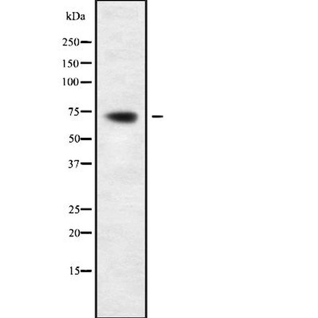 PIF1 Antibody in Western Blot (WB)