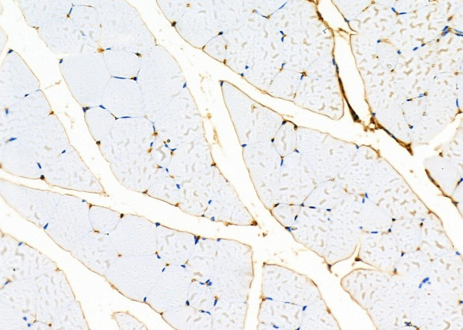 B4GALT4 Antibody in Immunohistochemistry (Paraffin) (IHC (P))