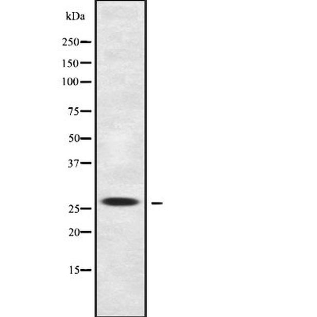 BSX Antibody in Western Blot (WB)